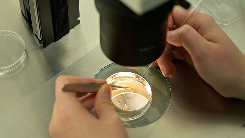 Ve 20 letech si Lenka nechala zmrazit vajíčka. Ženy by se měly starat o svoji plodnost, říká