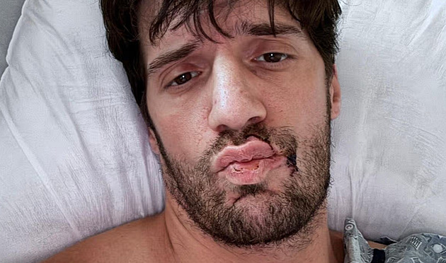 Bodali mě zezadu, popsal brutální útok americký herec z filmů pro dospělé