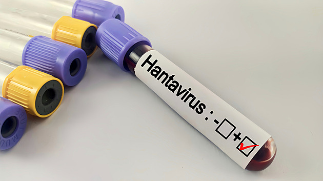 Hantaviry přenášené hlodavci řádí i v Česku. Smrt lesníka objasnila až pitva