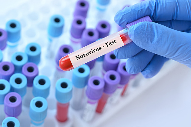 Děti ze školy v přírodě na Seči skončily v nemocnici, hygienici potvrdili norovirus