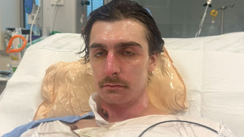 Robotický vysavač měl Australanovi explodovat u nohou, v nemocnici bojoval o život